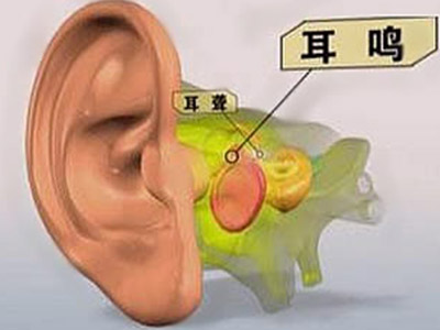 中耳炎手术有哪些作用？术后需要注意些什么?